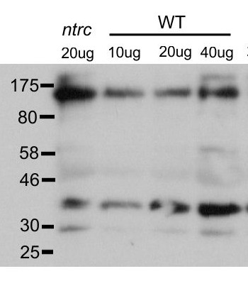 western blot using anti-PRK antibodies